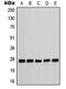 Cyclin Dependent Kinase Inhibitor 1B antibody, MBS821636, MyBioSource, Western Blot image 