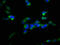 F-Box And Leucine Rich Repeat Protein 2 antibody, LS-C380235, Lifespan Biosciences, Immunofluorescence image 