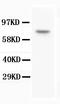 BRCA1 Associated Protein 1 antibody, MA1002, Boster Biological Technology, Western Blot image 