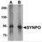 Synaptopodin antibody, TA319835, Origene, Western Blot image 