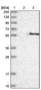 Fatty Acyl-CoA Reductase 2 antibody, NBP1-90435, Novus Biologicals, Western Blot image 