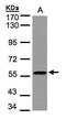 Dual Specificity Phosphatase 8 antibody, PA5-21292, Invitrogen Antibodies, Western Blot image 