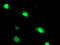 Phenylethanolamine N-methyltransferase antibody, LS-C172905, Lifespan Biosciences, Immunofluorescence image 