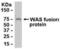 WAS antibody, XW-7675, ProSci, Western Blot image 