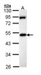 Membrane Palmitoylated Protein 1 antibody, LS-C186206, Lifespan Biosciences, Western Blot image 
