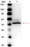 HK II antibody, R1093HRPS, Origene, Western Blot image 