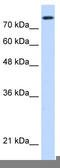 Non-SMC Condensin I Complex Subunit H antibody, TA339328, Origene, Western Blot image 