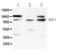 Amine Oxidase Copper Containing 1 antibody, LS-C662326, Lifespan Biosciences, Western Blot image 