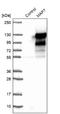 Microtubule Associated Protein 7 antibody, NBP1-84852, Novus Biologicals, Western Blot image 