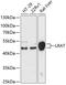 Lecithin retinol acyltransferase antibody, 14-835, ProSci, Western Blot image 