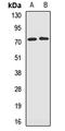Glutathione S-transferase C-terminal domain-containing protein antibody, LS-C668881, Lifespan Biosciences, Western Blot image 