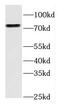 FYVE, RhoGEF And PH Domain Containing 3 antibody, FNab03085, FineTest, Western Blot image 