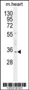 Uridine Phosphorylase 2 antibody, 55-545, ProSci, Western Blot image 