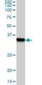 Signal Sequence Receptor Subunit 1 antibody, H00006745-M02, Novus Biologicals, Western Blot image 
