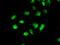STE20/SPS1-related proline-alanine-rich protein kinase antibody, M02516-1, Boster Biological Technology, Immunofluorescence image 