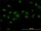 Double PHD Fingers 2 antibody, H00005977-M01, Novus Biologicals, Immunofluorescence image 