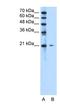 Uncharacterized protein C20orf24 antibody, NBP1-91332, Novus Biologicals, Western Blot image 