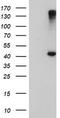 1-Acylglycerol-3-Phosphate O-Acyltransferase 5 antibody, TA504192S, Origene, Western Blot image 