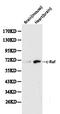 Raf-1 Proto-Oncogene, Serine/Threonine Kinase antibody, orb129571, Biorbyt, Western Blot image 