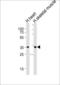 Iodothyronine Deiodinase 2 antibody, LS-C167417, Lifespan Biosciences, Western Blot image 