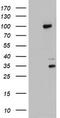 Progesterone Receptor antibody, TA802705BM, Origene, Western Blot image 