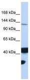 DNA mismatch repair protein Mlh3 antibody, TA346484, Origene, Western Blot image 