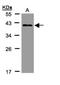 Kelch Domain Containing 8A antibody, NBP1-31181, Novus Biologicals, Western Blot image 