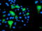 Potassium Voltage-Gated Channel Subfamily J Member 3 antibody, TA504193, Origene, Immunofluorescence image 