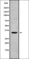 Keratin 32 antibody, orb337799, Biorbyt, Western Blot image 