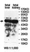 Pancreatic Lipase Related Protein 2 (Gene/Pseudogene) antibody, orb78391, Biorbyt, Western Blot image 