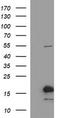 SIVA1 Apoptosis Inducing Factor antibody, CF506836, Origene, Western Blot image 