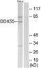 DEAD-Box Helicase 55 antibody, PA5-39044, Invitrogen Antibodies, Western Blot image 