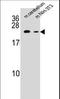 RAB12, Member RAS Oncogene Family antibody, LS-C162359, Lifespan Biosciences, Western Blot image 