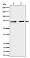 Solute Carrier Family 25 Member 12 antibody, M04746, Boster Biological Technology, Western Blot image 