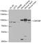 Lysine Acetyltransferase 14 antibody, GTX65856, GeneTex, Western Blot image 