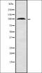 Rhophilin Rho GTPase Binding Protein 1 antibody, orb337510, Biorbyt, Western Blot image 