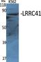 Leucine Rich Repeat Containing 41 antibody, A13640, Boster Biological Technology, Western Blot image 