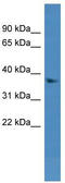 Dehydrogenase/Reductase 7 antibody, TA341994, Origene, Western Blot image 