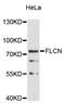 Folliculin antibody, abx126912, Abbexa, Western Blot image 