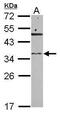 Ribonuclease T2 antibody, PA5-32031, Invitrogen Antibodies, Western Blot image 