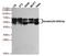 Keratin 5 antibody, TA346990, Origene, Western Blot image 