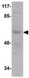 INSM Transcriptional Repressor 1 antibody, GTX85243, GeneTex, Western Blot image 