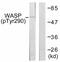 WASP antibody, ab59278, Abcam, Western Blot image 