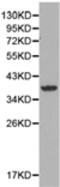 Neutrophil cytosol factor 4 antibody, TA323606, Origene, Western Blot image 