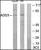 Adducin 3 antibody, orb179022, Biorbyt, Western Blot image 