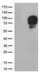 Signal Regulatory Protein Alpha antibody, TA807713, Origene, Western Blot image 