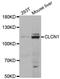 Chloride Voltage-Gated Channel 1 antibody, TA332875, Origene, Western Blot image 