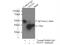 Phosphoserine aminotransferase antibody, 10501-1-AP, Proteintech Group, Immunoprecipitation image 