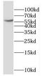 Dipeptidyl Peptidase 9 antibody, FNab02523, FineTest, Western Blot image 