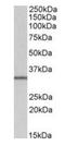 SLC9A3 Regulator 2 antibody, orb19072, Biorbyt, Western Blot image 